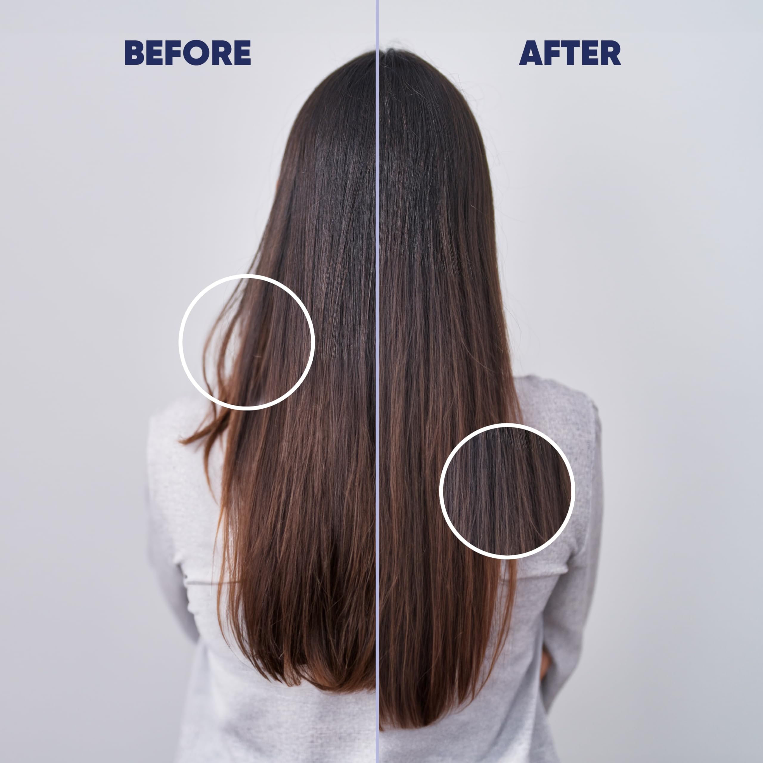 Moerie Hair Growth Serum 50 ml, for Accelerating Hair Growth & Against Hair Loss in Women, Hair Boost Scalp - Image 3