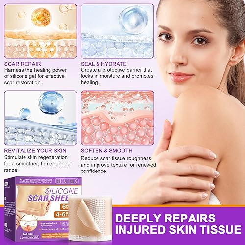 Miniatura 3 de Hojas de silicona para cicatrices, cinta de silicona para cicatrices (1.6 x 60 pulgadas), cinta de cicatriz de grado médico para cicatrices