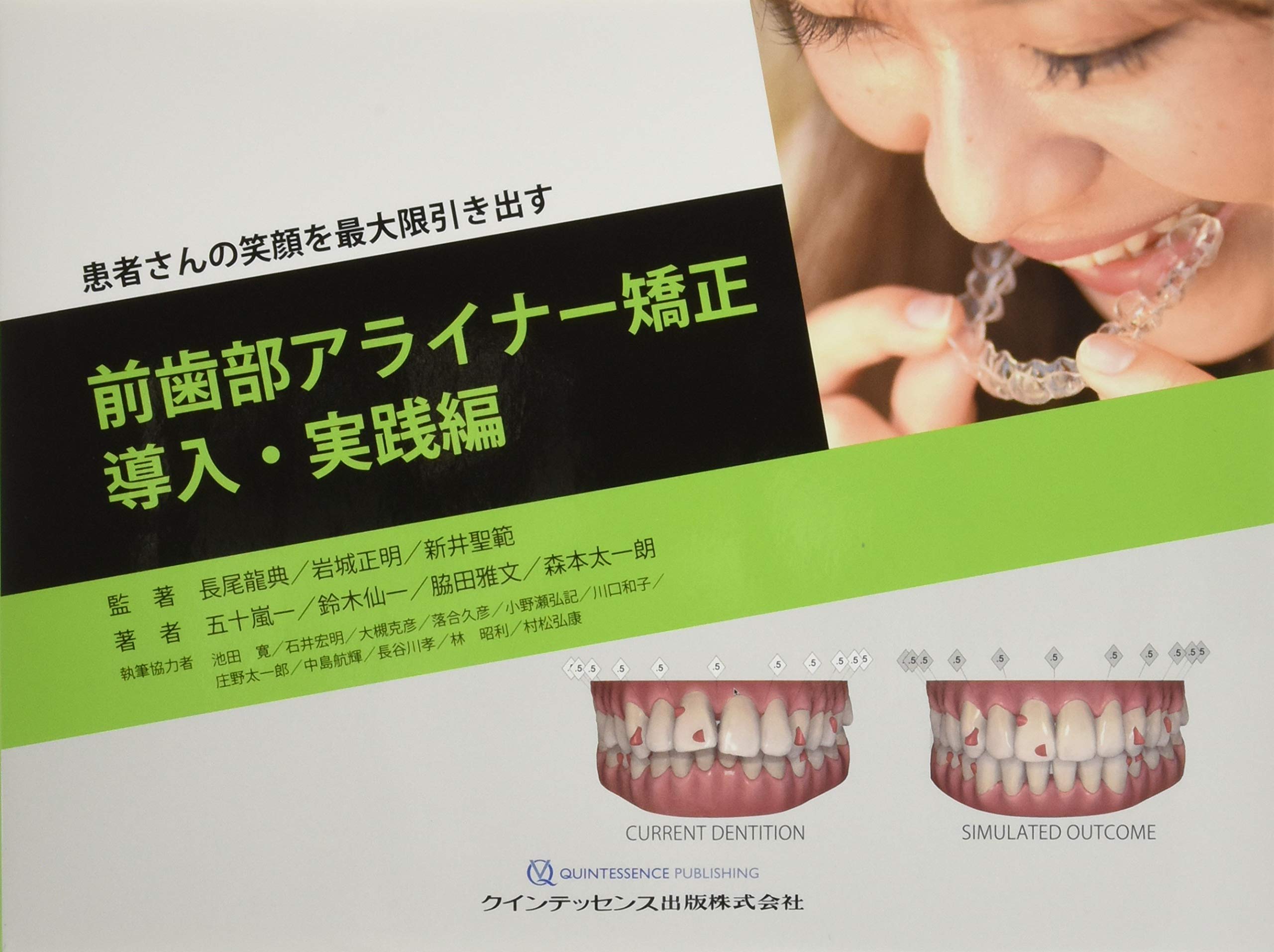 前歯部アライナー矯正導入・実践編 | 長尾 龍典, 岩城 正明, 新井 聖範