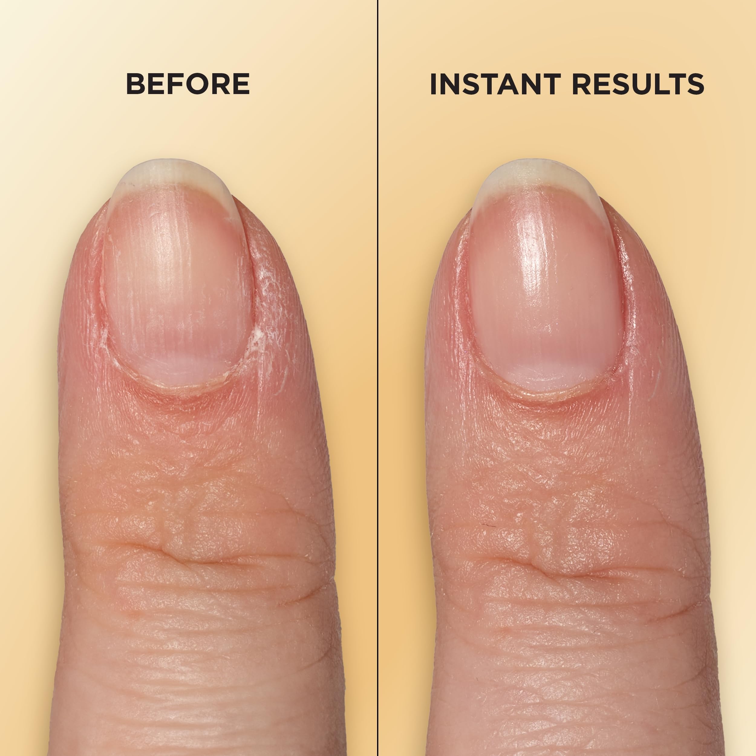 Sally Hansen Vitamin E Nail & Cuticle Oil Pen, Trattamento per unghie, Formato Penna da viaggio per cuticole