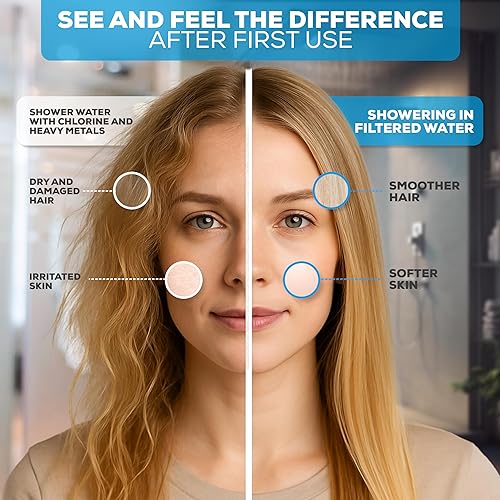 Miniatura 3 de SparkPod Juego de cabezal de ducha filtrado de lujo de 23 etapas, elimina el cloro y los metales pesados, filtro de regadera de alta presión (6
