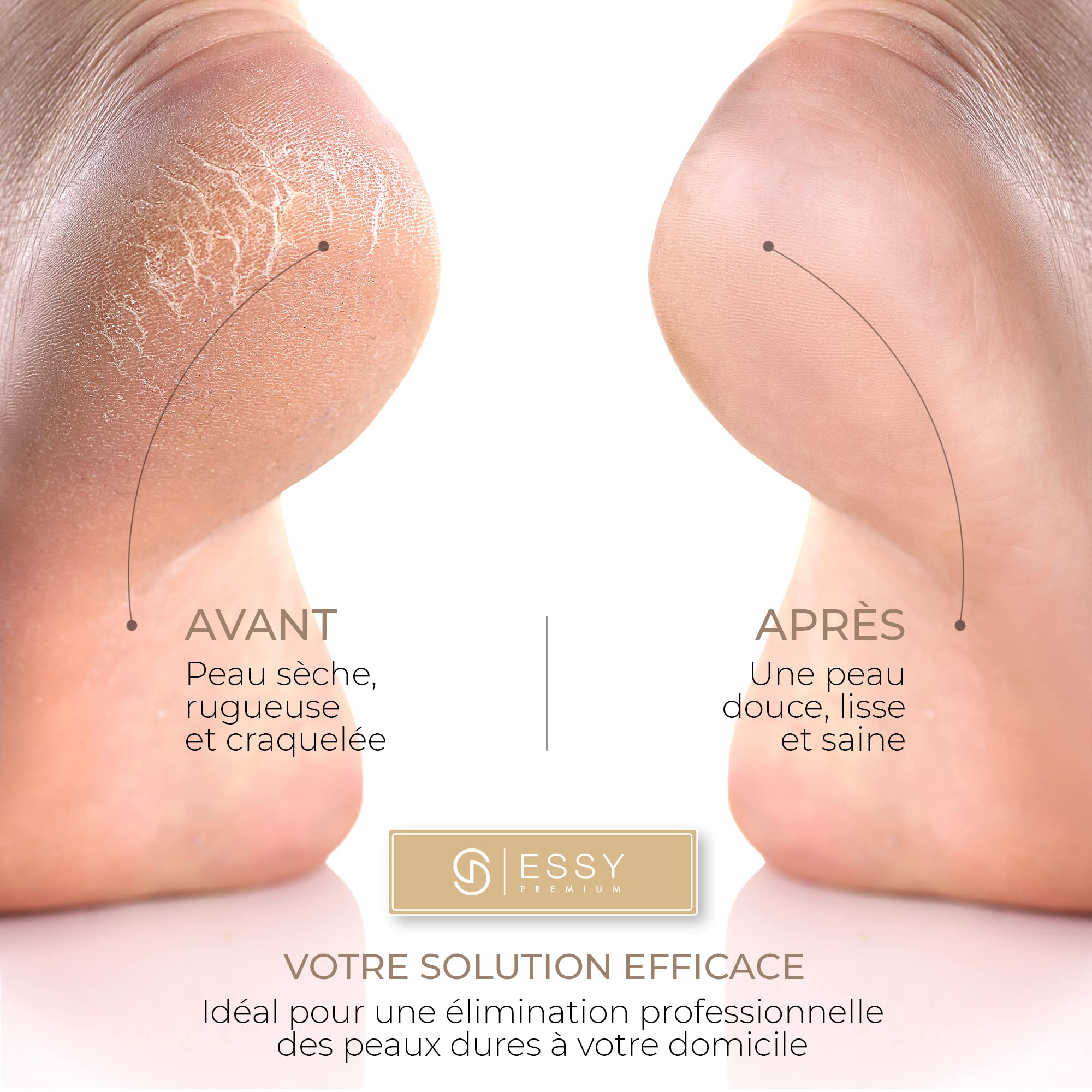 Essy Râpe à Pieds Électrique avec 5 Rouleaux de Remplacement, Ponceuse Rechargeable pour Élimination des Callosités, 2 Vitesses, Écran LED, Charge USB, Kit Pédicure (Blanc)