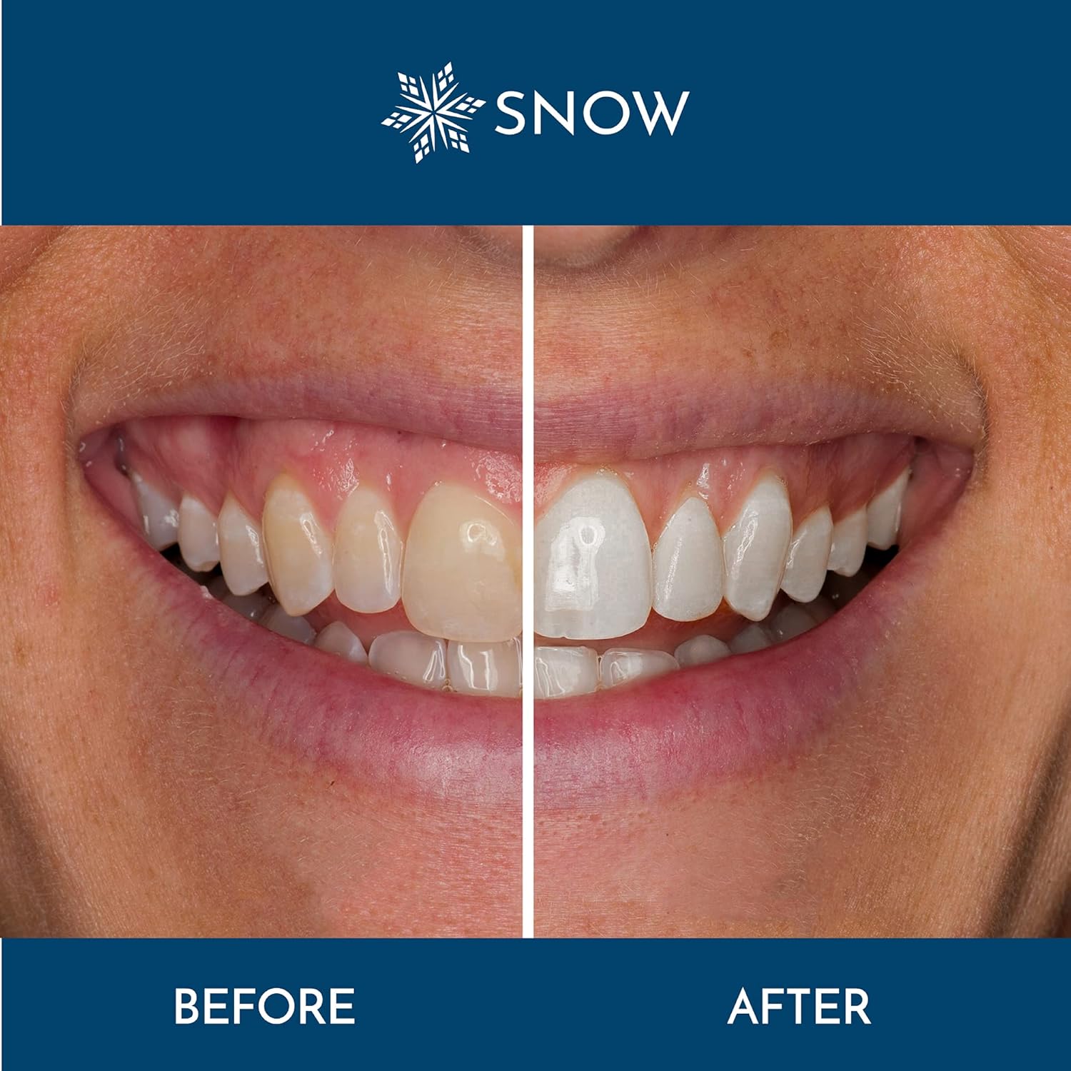 Snow Teeth Whitening Serum Refill (2 Pack) - Regular Strength Wands | Keep Up Your Whitening Routine : Beauty & Personal Care