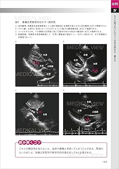 今さら聞けない 心エコー図100 | 村田 和也 |本 | 通販 | Amazon