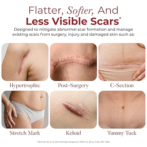 Miniatura 5 de HealFast Hojas de cicatrices de silicona formuladas por médicos, cinta de silicona de grado médico de crosspolímero avanzado para cirugía, sección