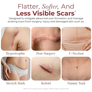 HealFast Physician Formulated Silicone Scar Sheets - Advanced Crosspolymer Medical Grade Silicone Scar Tape for Surgery, C Section, Keloids & Hypertrophic Scars - Silicone Tape For Scars