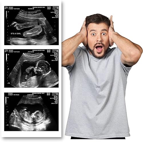 Miniatura 5 de Pranknant Imágenes de broma de ultrasonido falso  Tira 2D de 3 fotos  Sonograma de embarazo  Ultrasonido de embarazo de broma (gemelos)