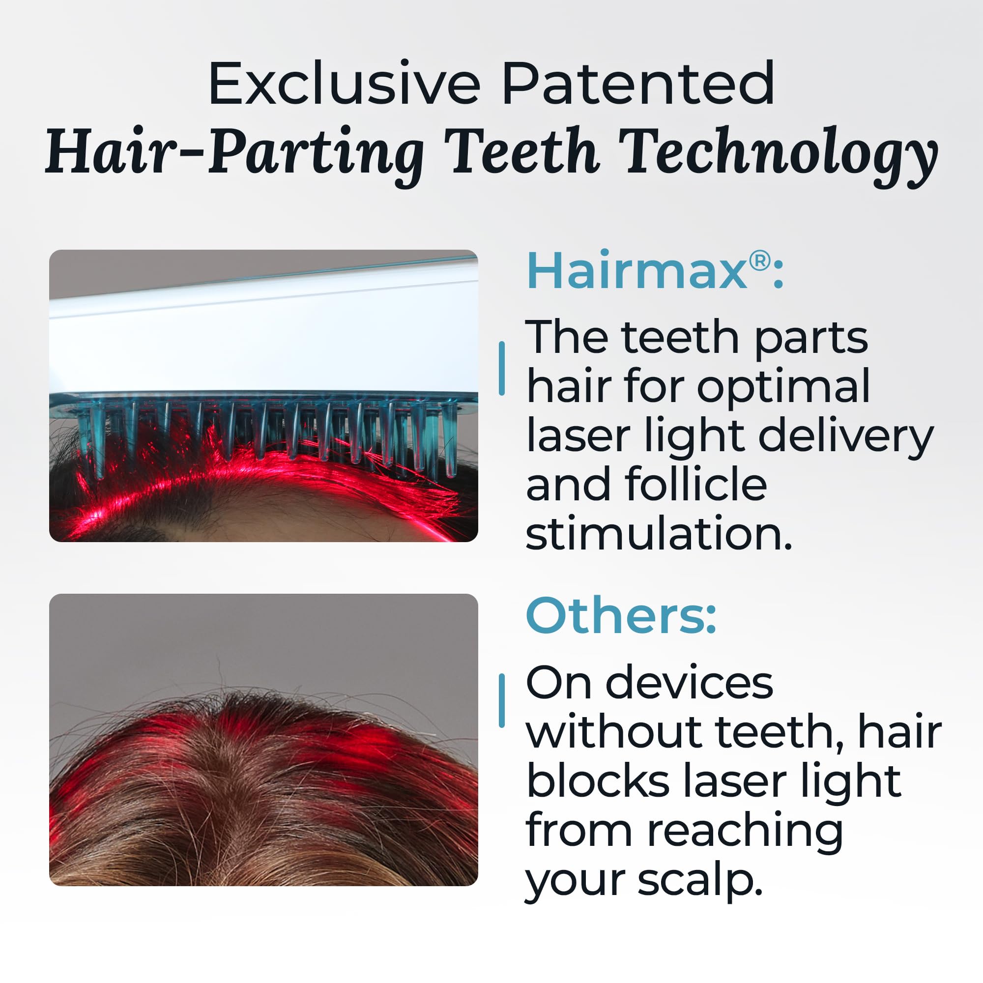 Hairmax Ultima 12 Classic LaserComb FDA Cleared Red Light Hair Regrowth | Reverse Thinning Hair For Men & Women with 100% Medical Grade Lasers product thumbnail 6