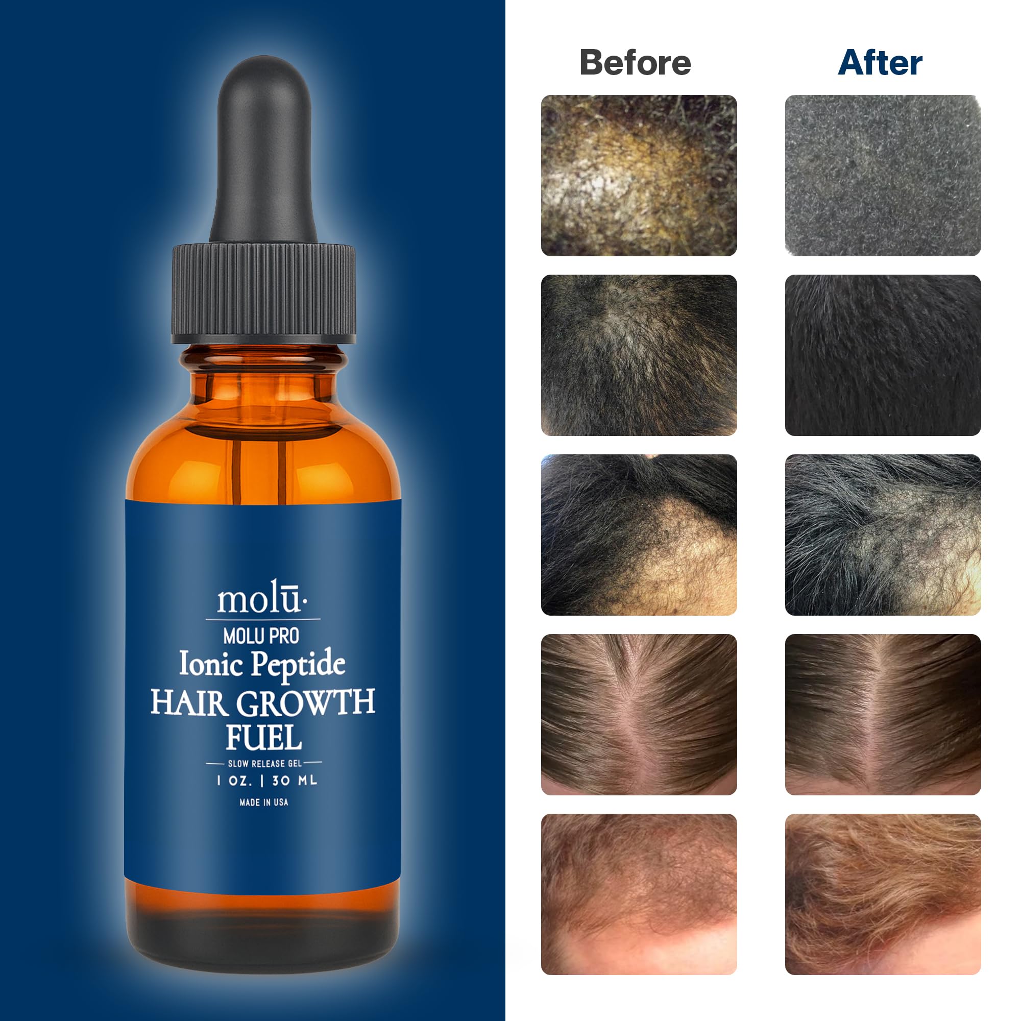 klow peptide hair growth Peptides for Loss: The Science & Do They Really Work? | Dr. Jonathann Kuo Molu Pro AHKCu & GHKCu
