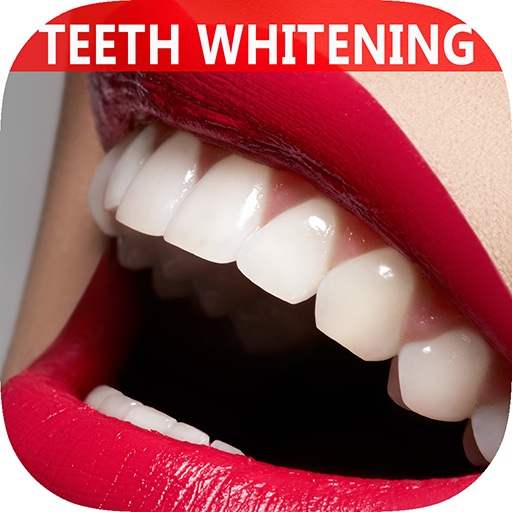 best over-the-counter teeth whitening kits
