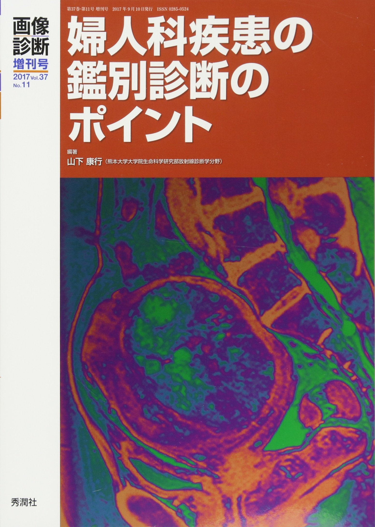 画像診断2017年増刊号vol.37 No.11 ~婦人科疾患の鑑別診断のポイント~ [単行本] 康行，山下 画像診断2017年増刊号vol.37 No.11 ~婦人科疾患の鑑別診断の