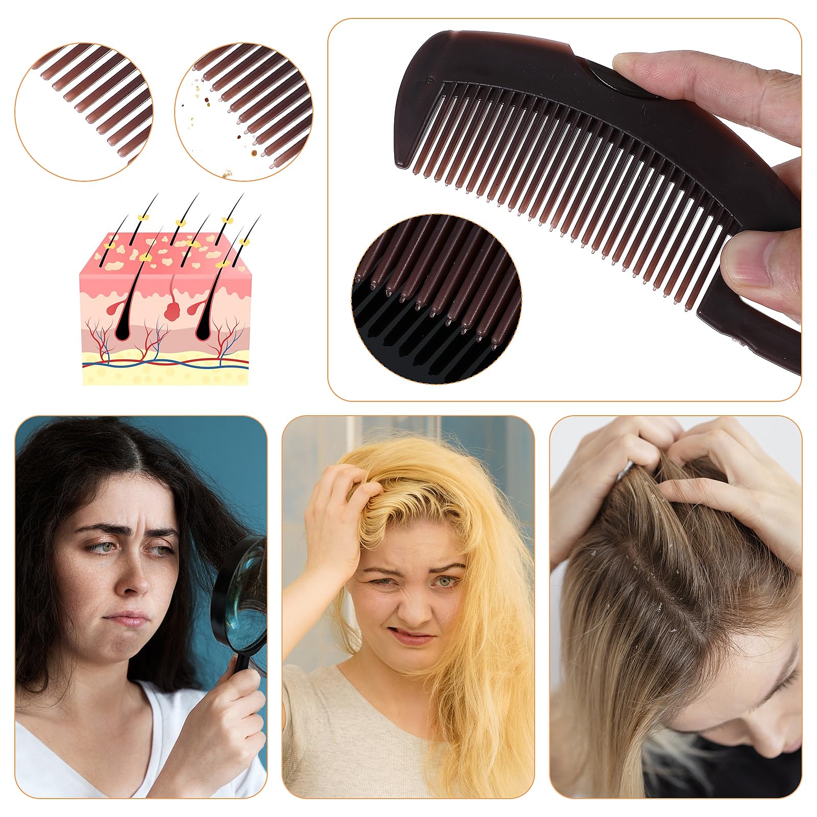Nogeqi 2 Stück Kopfhaut Kamm Reinigung Schuppenkamm Erwachsene Schuppen Kamm, Kopfhautkamm, Dandruff Comb, Press Scalp Detox Comb Entfernung von Schuppen und Schmutz für Frauen Männer