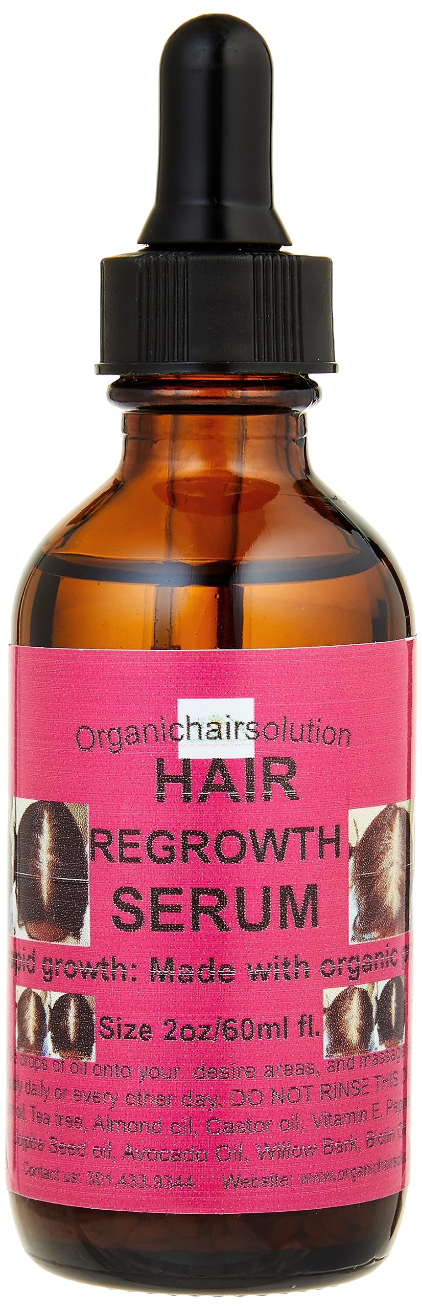 Edge growth Serum- Scalp & Hair Oil-For Strengthening - Growth, Thicker Longer Hair-for Split Ends &Dry Scalp Dandruff- WithPeppermint-Avocado-Castor-Amla- Argan (2oz)