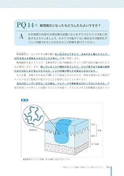 患者さんのためのリンパ浮腫外科的治療ガイドブック | 日本形成