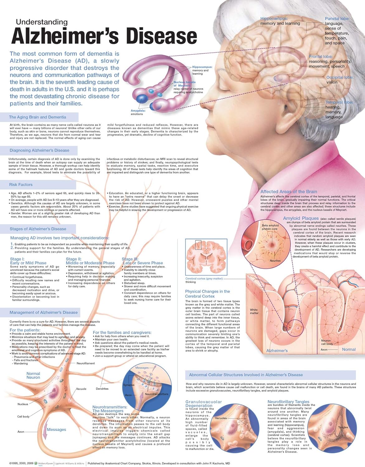 Understanding Alzheimer's Disease Anatomical Chart