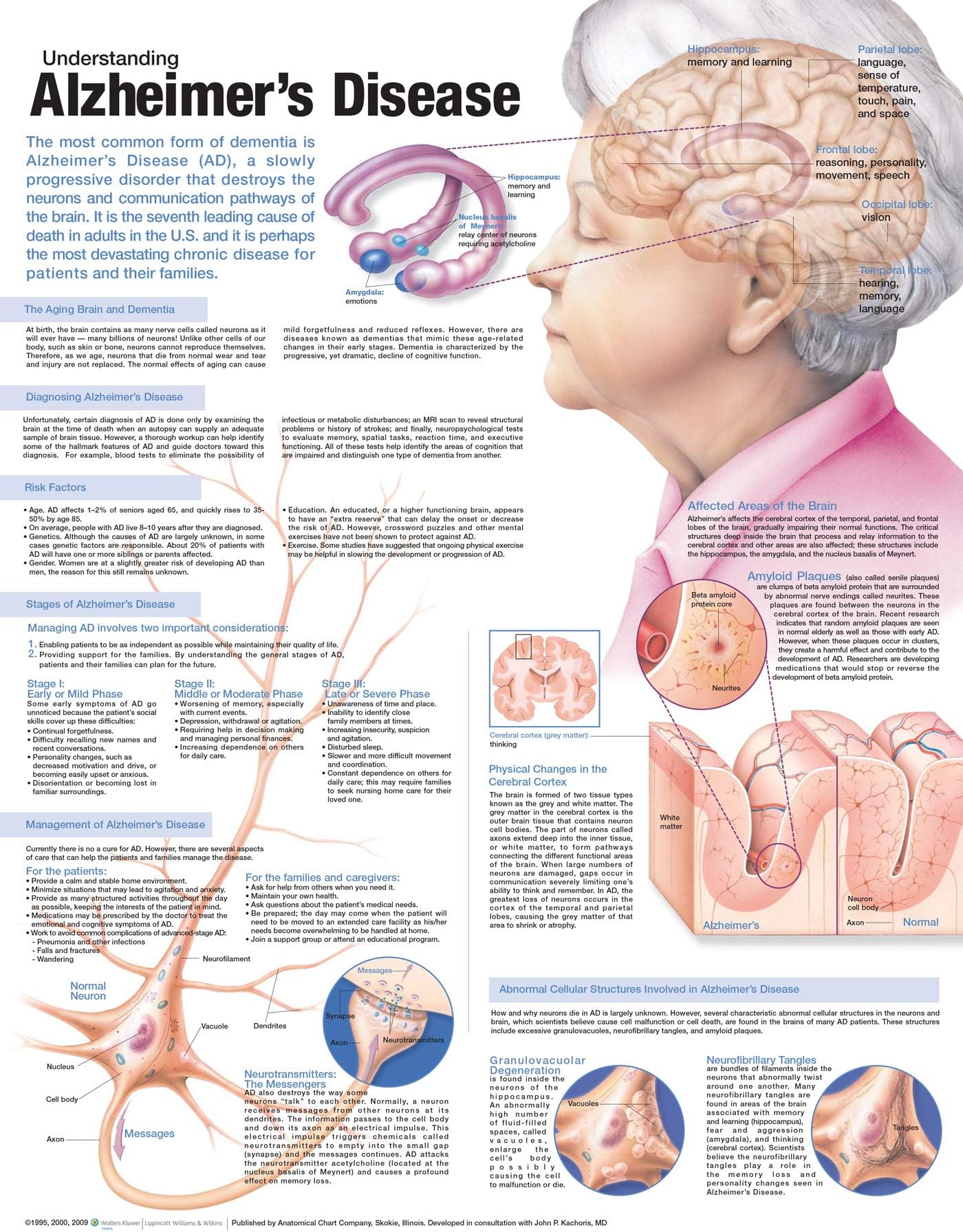 Understanding Alzheimer's Disease