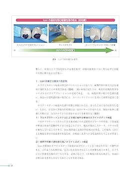 テーラーメード型MI審美歯科治療 テーラーメイド型 MI審美歯科治療―ホワイトニング・レジン浸潤法