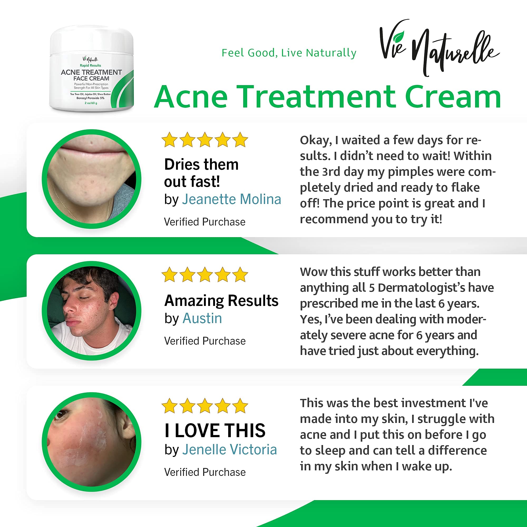 Natural Acne Treatment Cream with Benzoyl Peroxide Spot Treatment