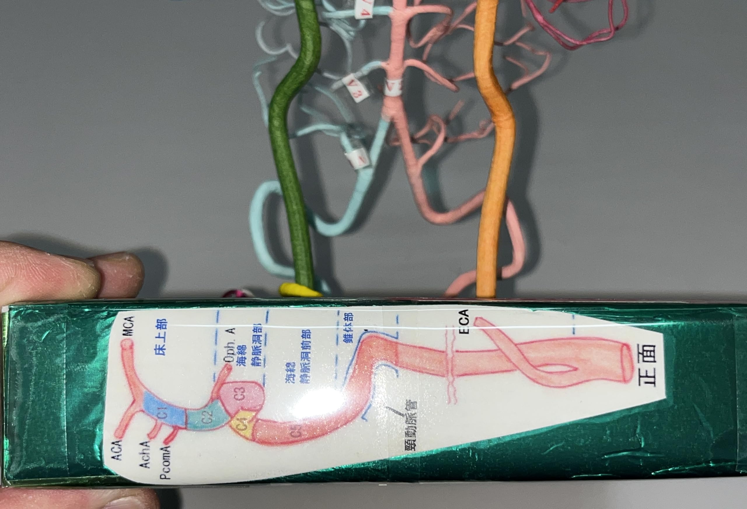 脳血管模型（脳血管模型を作れない必要な人のために） 脳血管模型KAGAWAモデル Amazon.co.jp: 脳血管模型：教育用（オリジナルプロダクト） : 産業