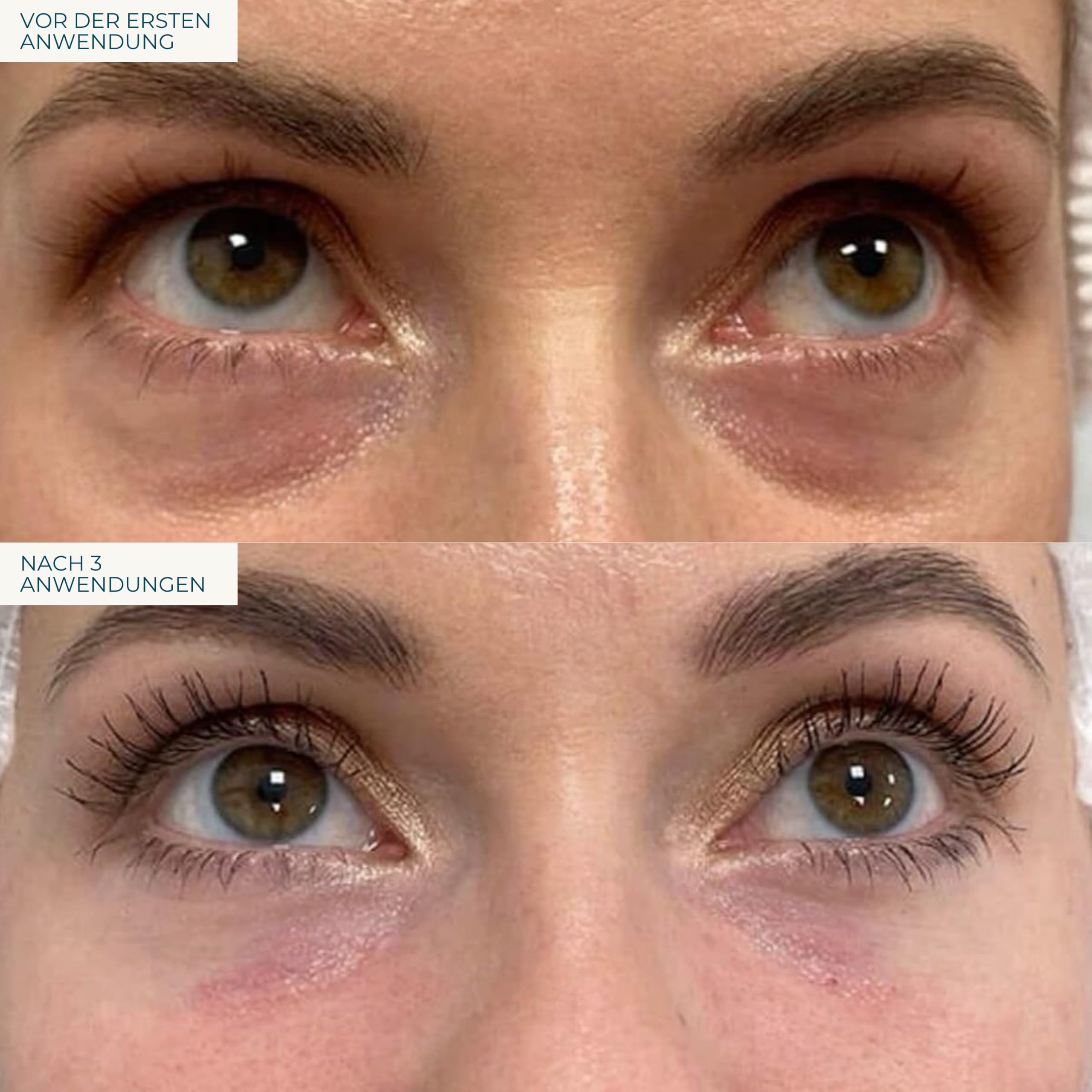 Eye Cream - Augencreme mit Bacillus Ferment - mit Shea Butter und Aloe - wirkt gegen geschwollene Augen, gegen Tränensäcke, gegen Falten - ohne Parabene, ohne Alkohol