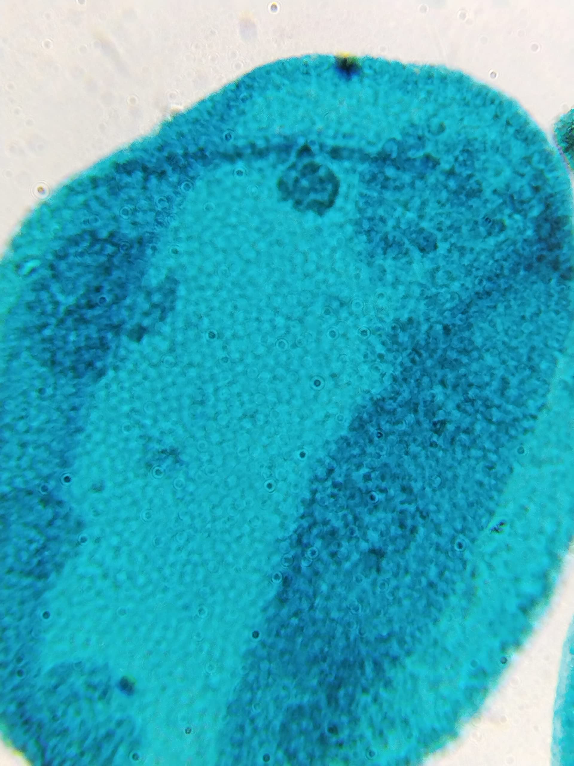 Anand traders 45x objective for microscope,superiy quality - Image 3 thumbnail