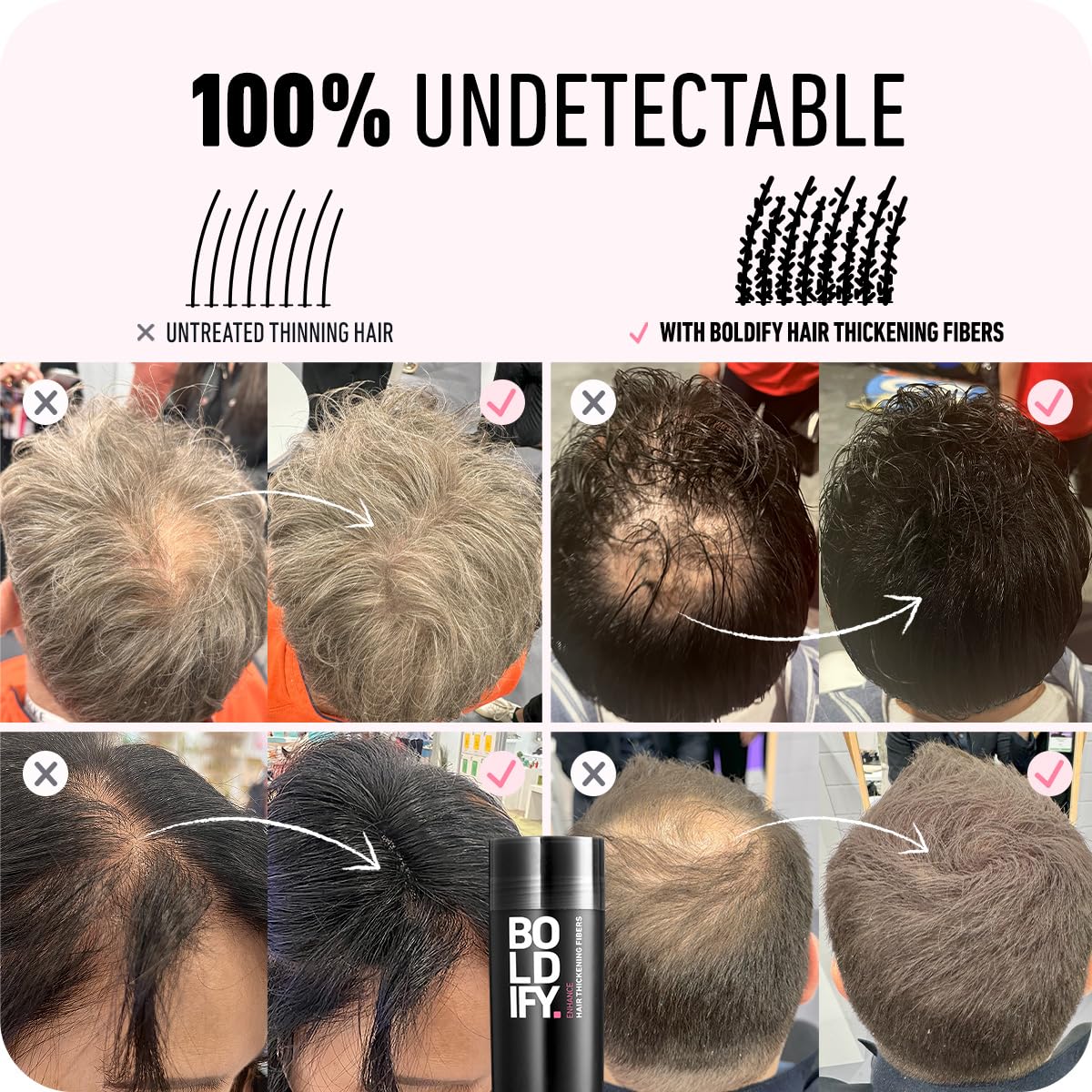 Amazon.com: Hair Fiber (Dark Auburn) + Hairline Powder (Dark  display picture 2