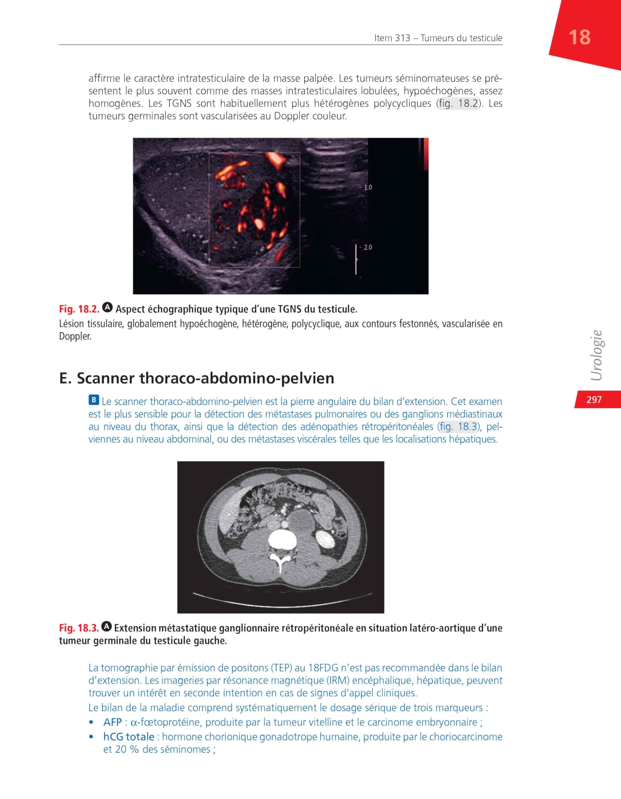 Urologie: Réussir ses EDN