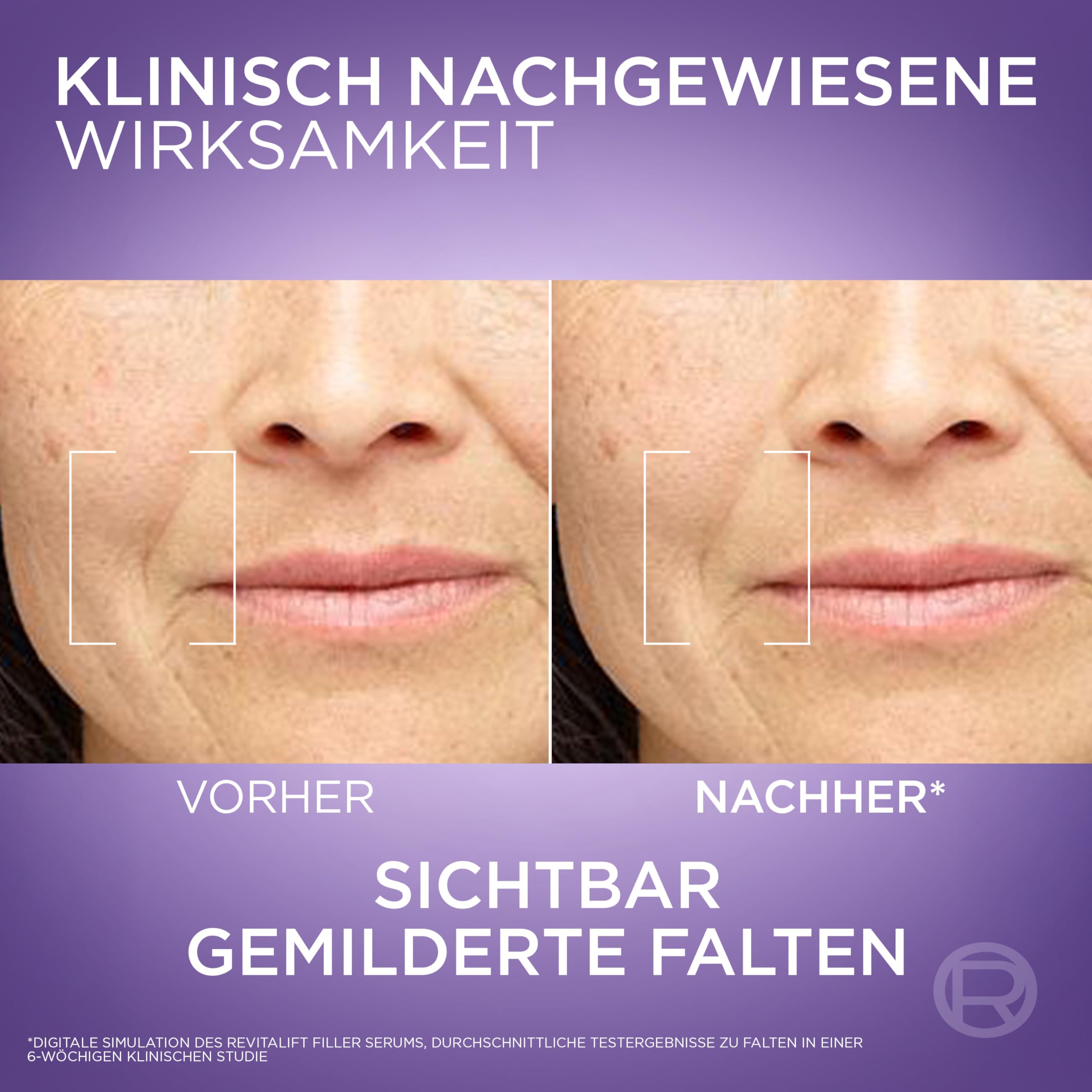 L’Oréal Paris Revitalift Filler Serum Przeciwzmarszczkowe, 30 ml