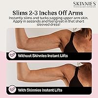 Vista 3 de Skinnies - Cinta de brazo patentada y fabricada en Estados Unidos, cinta de levantamiento de brazos para brazos flácidos, invisible y resistente al
