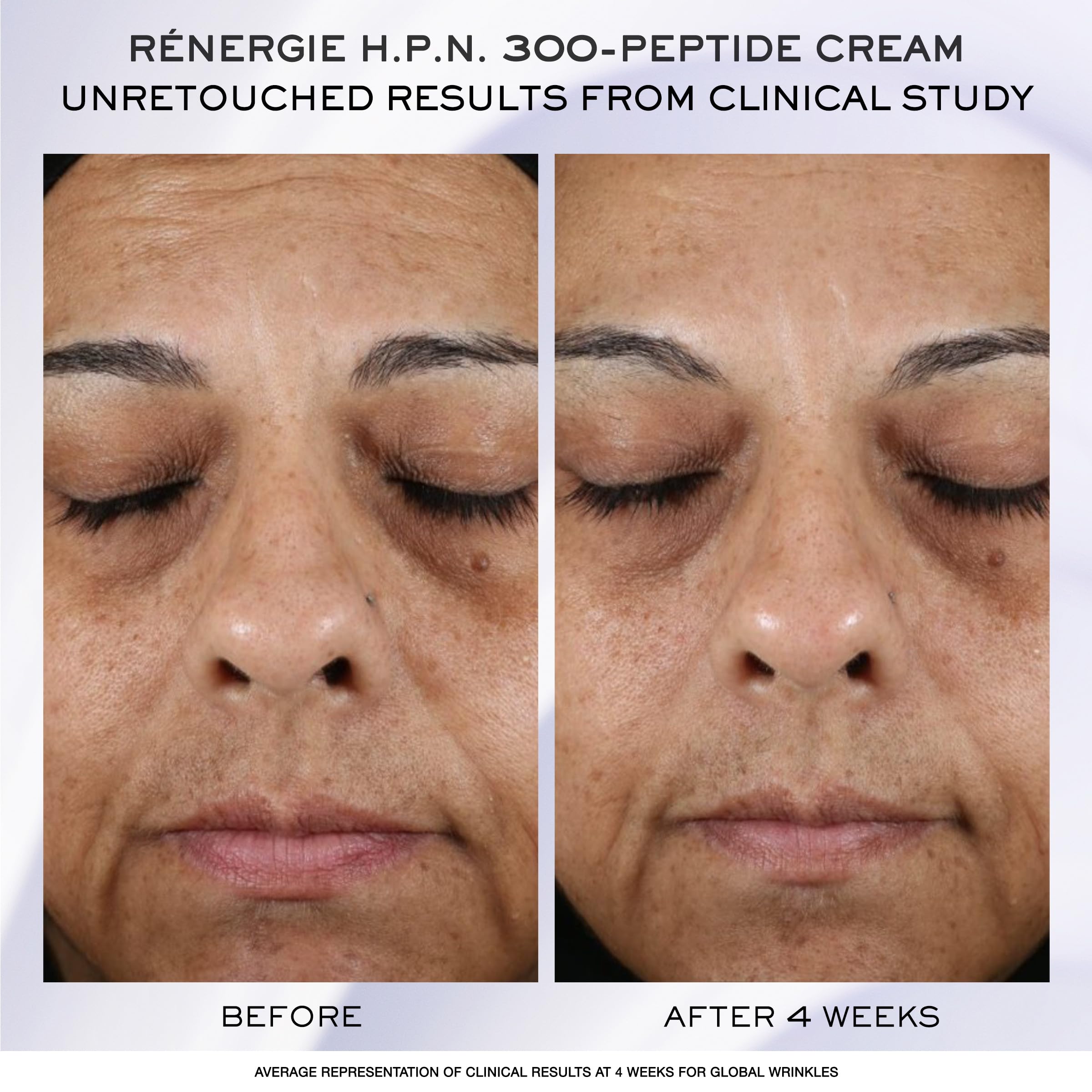 Lancôme Rénergie H.C.F. Triple Serum Discovery Set