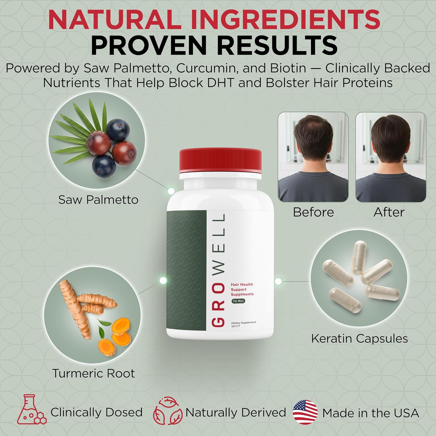 GroWell Hair Growth Supplements for Men – Clinically tested for visibly thicker hair and scalp coverage – All natural ingredients, saw palmetto to block DHT – Drug-free, Safe – Doctor recommended