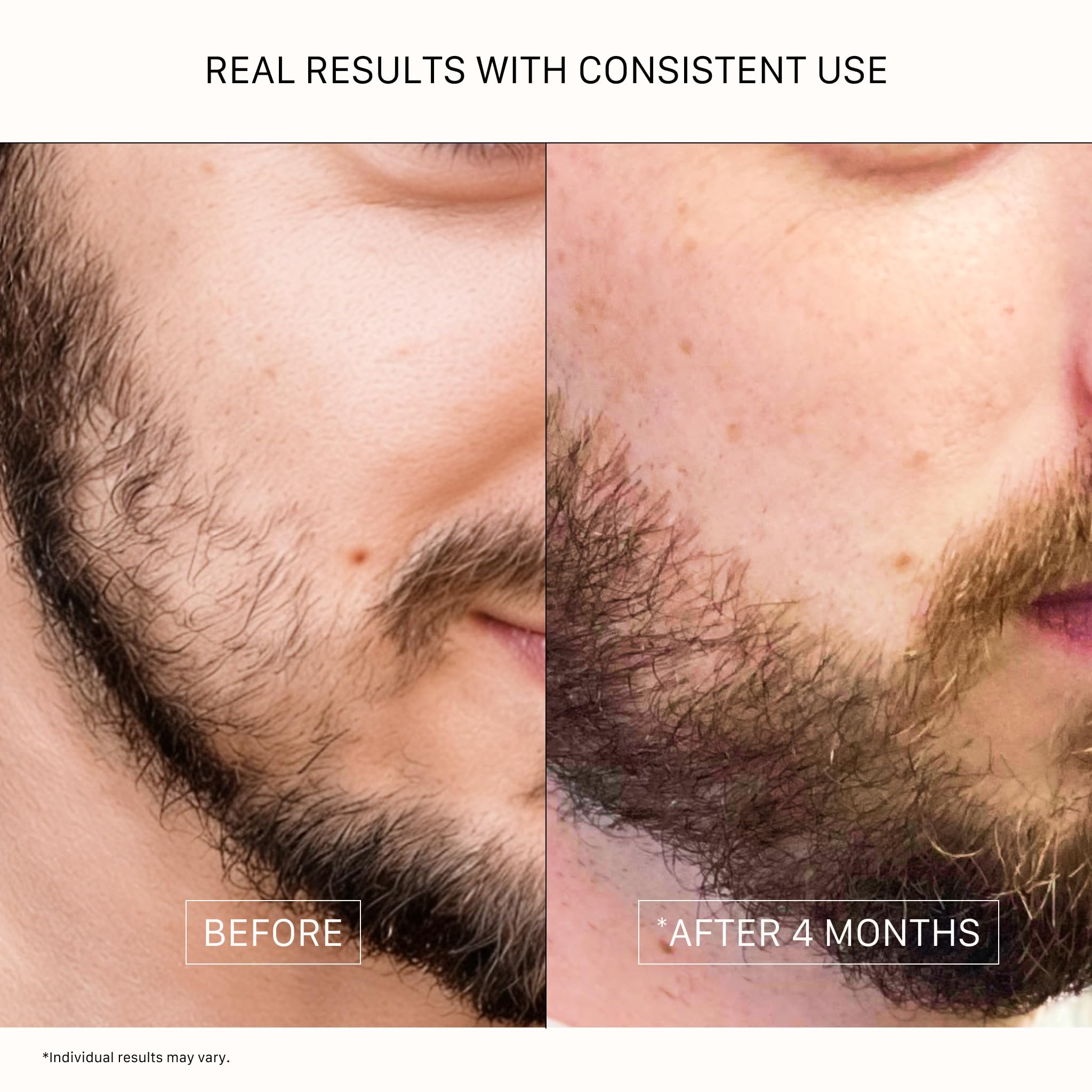 ACTIIV Thickening Beard Oil | Promotes Thicker Fuller Beard Growth, Nourishes & Softens Facial Hair, Lightweight Non-Greasy Formula, Vegan, Plant-Based, All Beard Types