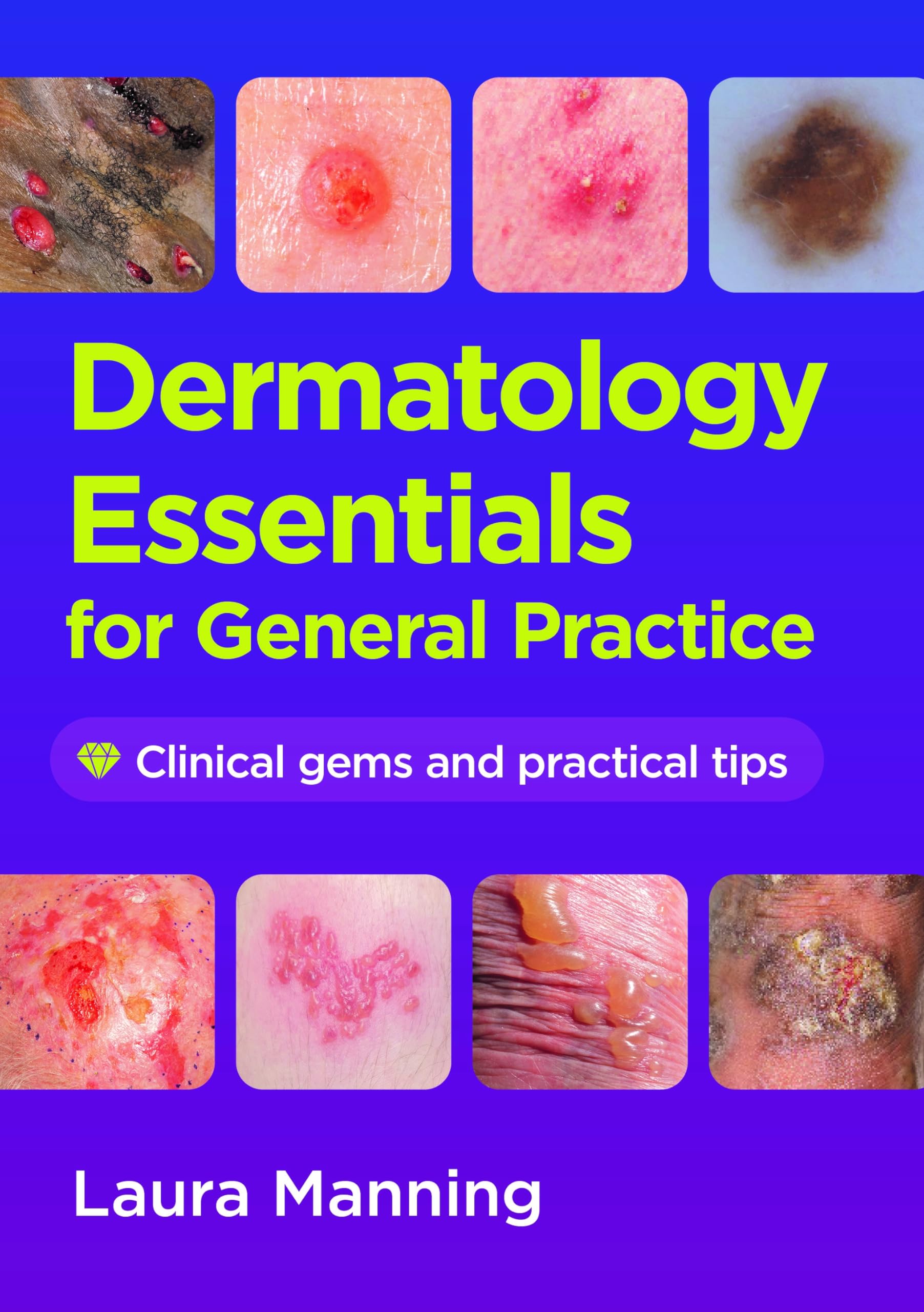 Dermatology Essentials for General Practice: Clinical Gems and Practical Tips