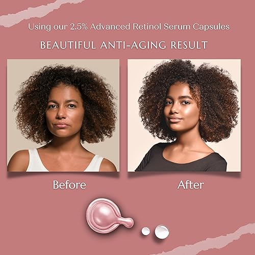 Miniatura 3 de Cápsulas de suero de retinol puro al 2.5%. Luce 5 años más joven en 30 días. Potente antienvejecimiento, hidratación profunda, iluminación, reduce