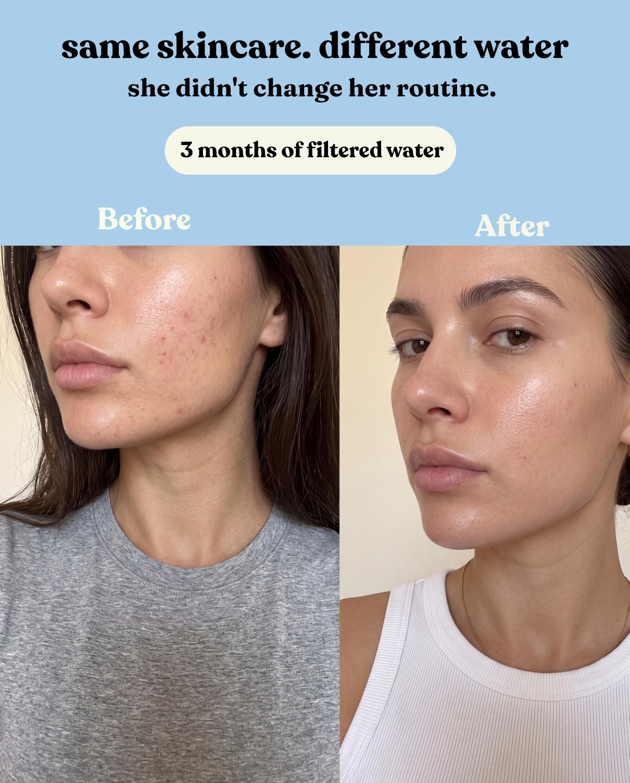 Cabezal de ducha filtrado de alta presión: filtra el cloro, los metales pesados y los microplásticos para una piel más suave y un cabello más saludable, vitamina C y suavizante de agua mineral para