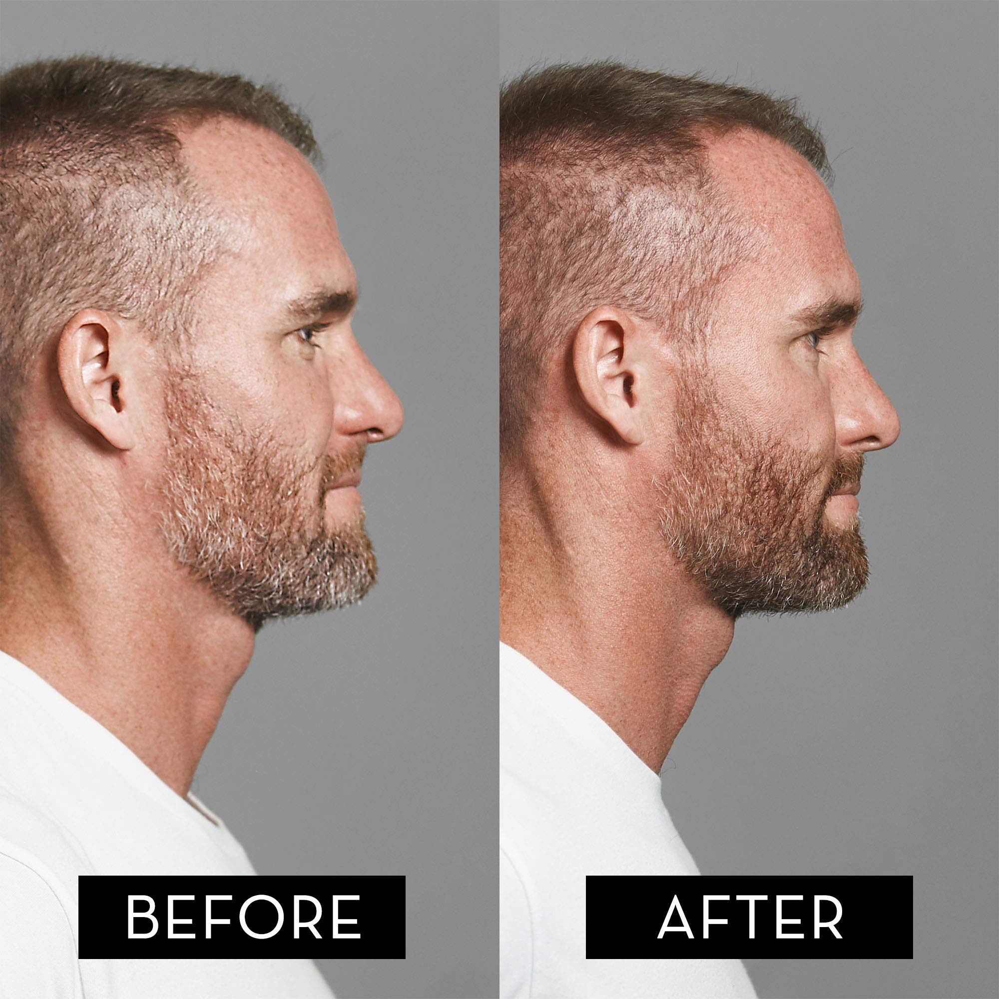 True Sons Beard and Mustache Hair Dye Formula for Men (1.75 oz) Hair