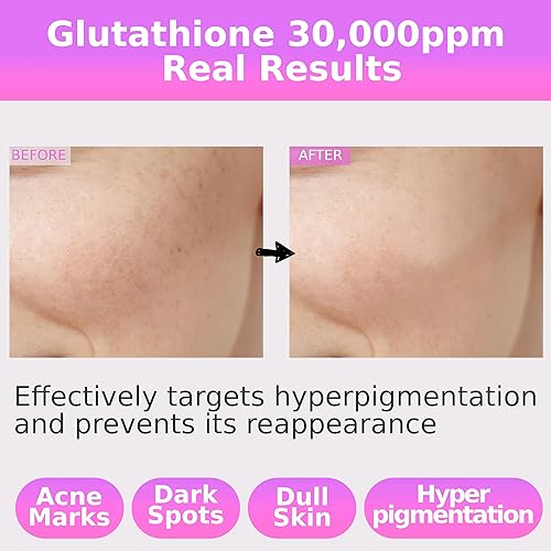 Miniatura 3 de Pure Glutathione Glow Serum 30,000 ppm para manchas oscuras y tono desigual  Fórmula que aumenta el resplandor con niacinamida, 5 veces ácido