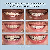 Vista 7 de Kit blanqueador de dientes, luz de LED, peróxido de carbamida del 35 %, (2) jeringuillas del gel 0.17 onzas líquidas, bandeja
