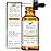 Health Priority Naturals|Vitamin E Oil - for Face/Hair - Organic, Handmade, Non-GMO, Gluten-Free, Vegan - For Scars, Wrinkles, Stretch Marks - Scented, 15,000 IU, 0.5 Fl Oz