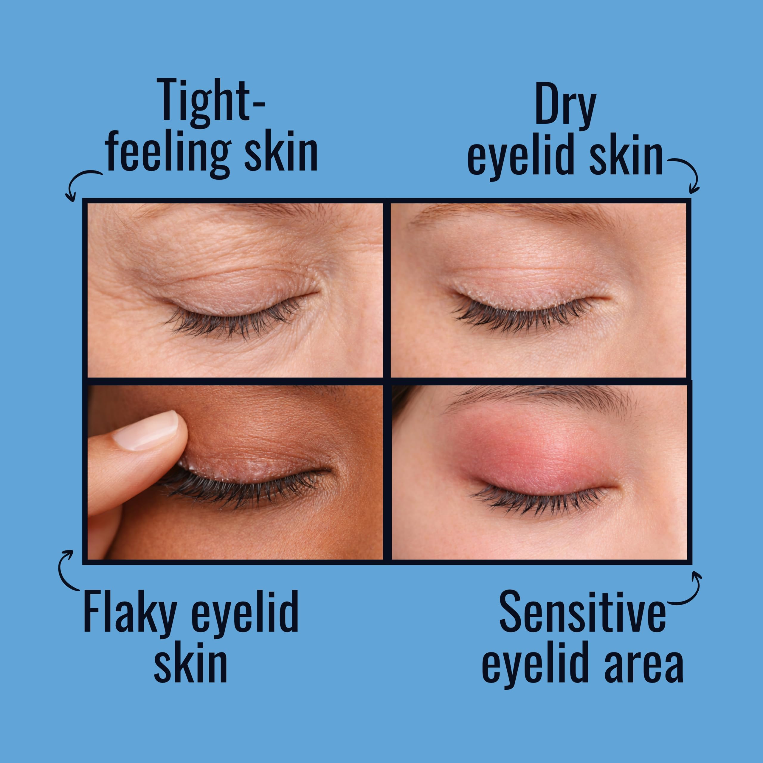 NOVEHA NIGHTTIME Eyelid Ointment Night Gel For Dry Eye Relief | Long Lasting Moisturizer Preservative Free | Moisturizing Cream for Night, External Use Only | 0.35 Oz / 10 gr — Amazon image 4