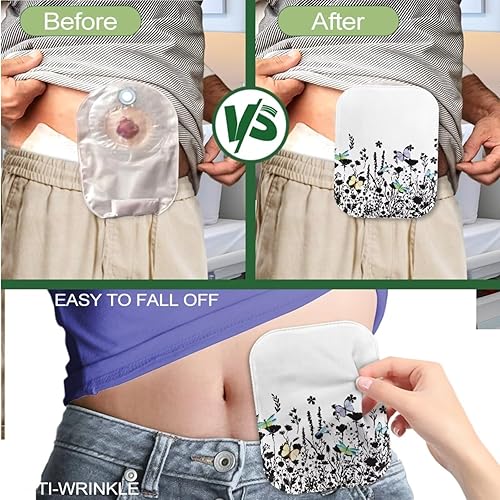 Miniatura 5 de Rnyleeg 4 fundas para bolsas de ostomía para mujer, diseño floral, funda elástica para el cuidado del estoma de ileostomía, fundas cómodas para