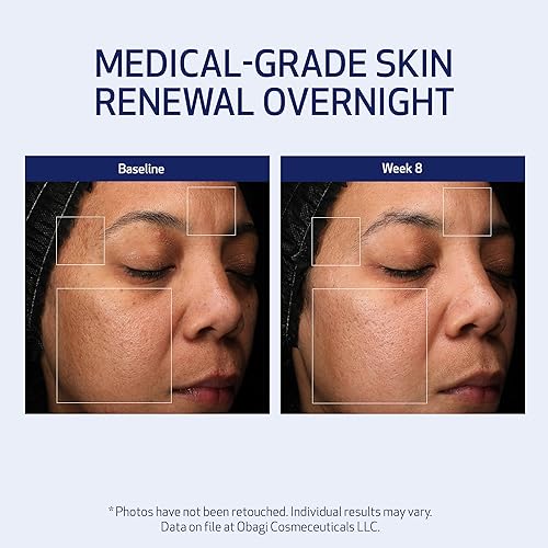 Miniatura 4 de Obagi Medical Retinol + PHA Refining Night Cream - Clínicamente probada, de doble acción, crema facial antienvejecimiento durante la noche para una