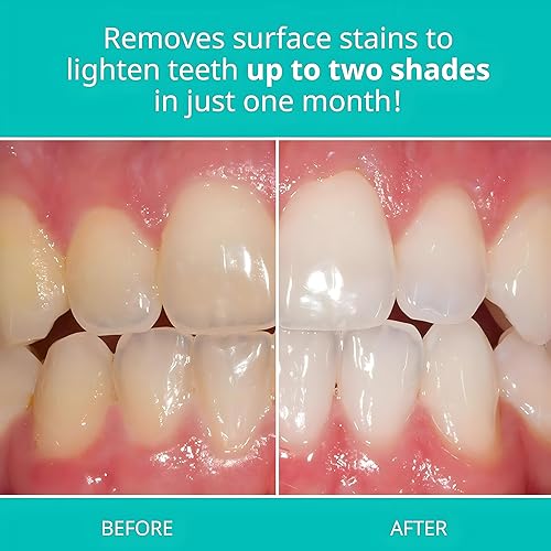 Miniatura 4 de Opalescence Pasta dental blanqueadora para dientes sensibles (paquete de 6) - Cuidado bucal, sabor menta, sin gluten - 5167-6