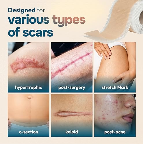 Miniatura 4 de Hojas reutilizables de silicona para cicatrices (120 x 1.6 pulgadas), hojas de silicona de grado médico para cicatrices quirúrgicas, quemaduras,