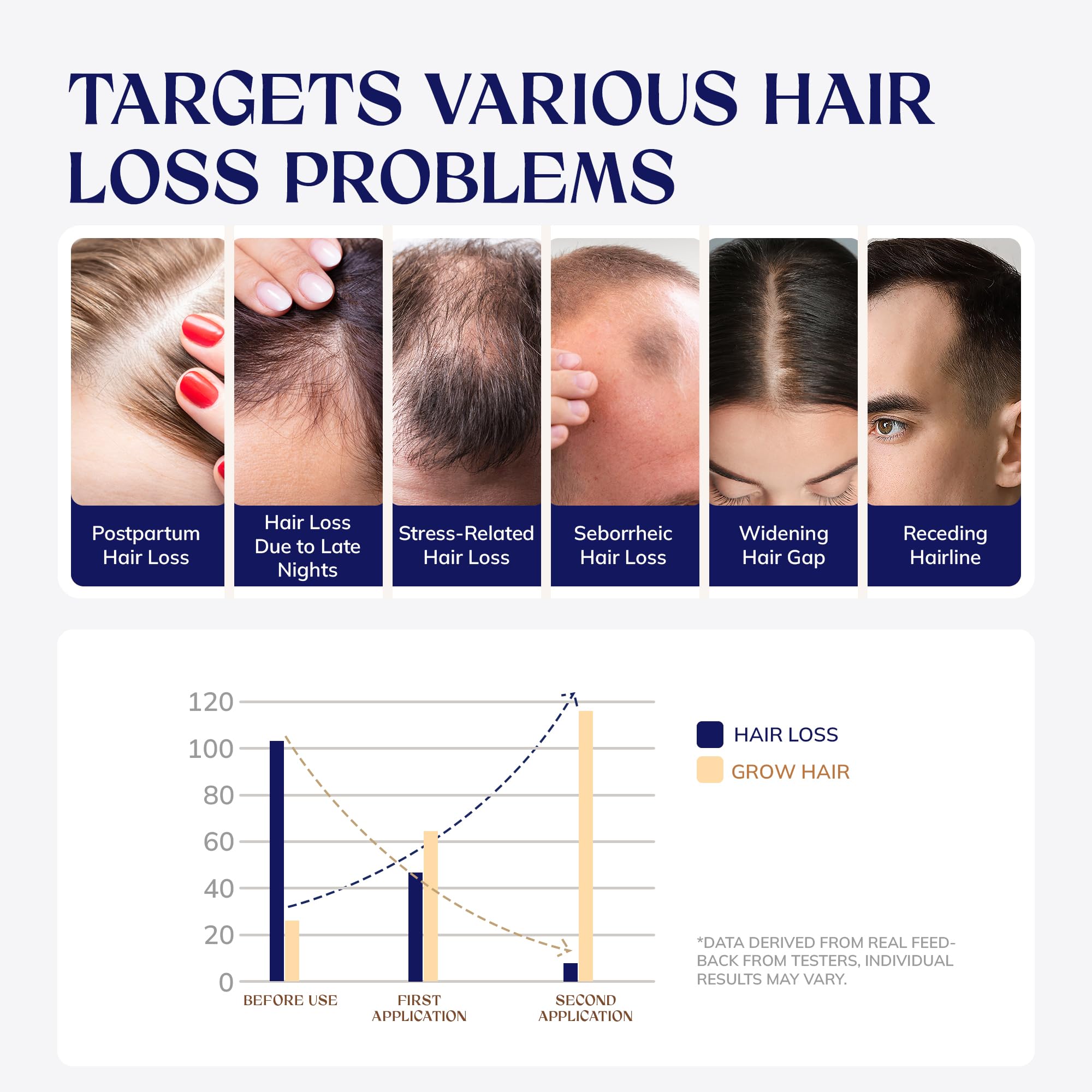 Rootstim Hair Growth Serum Spray with Biotin, Rice Water & Caffeine, 2.03 Fl Oz