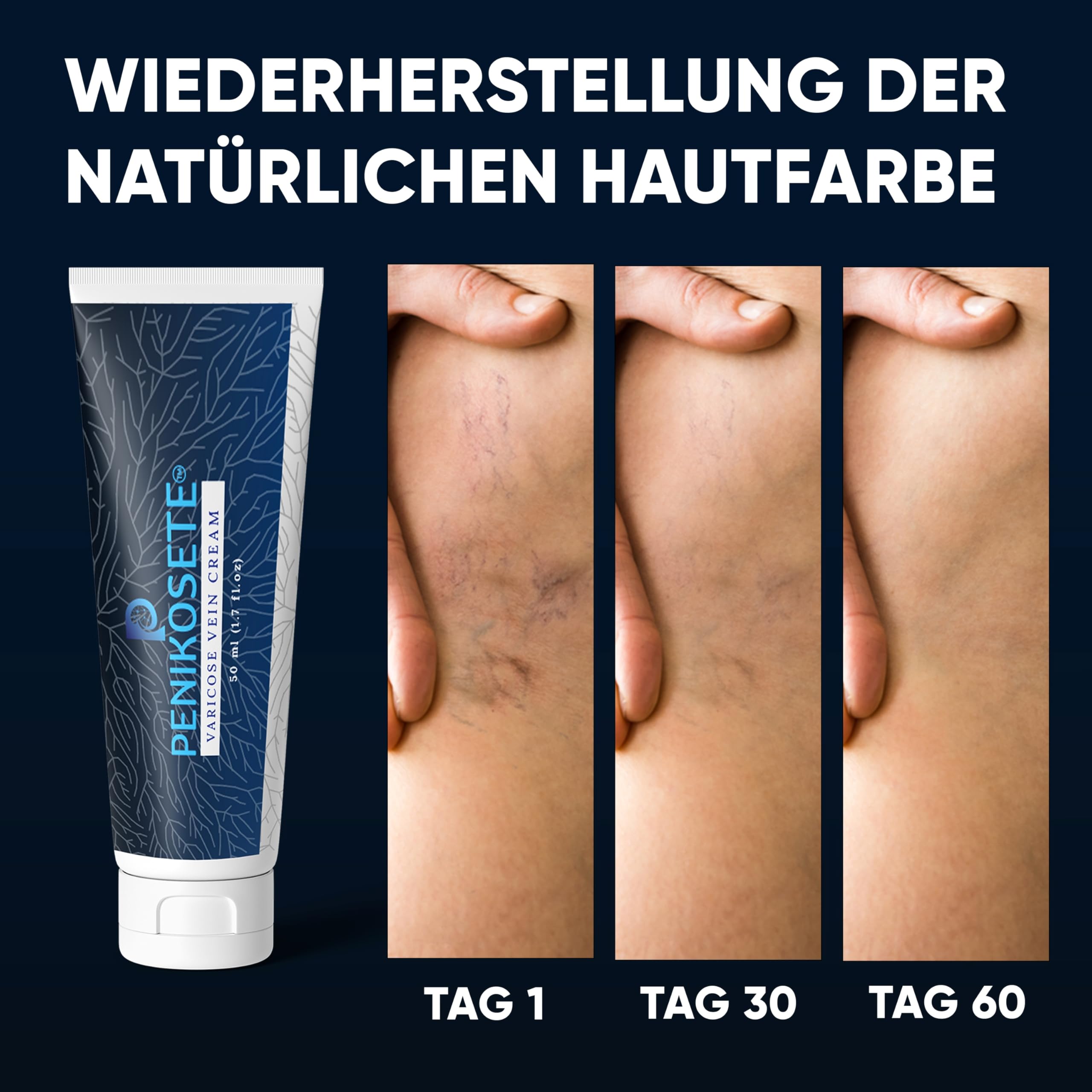 PENIKOSETE Venenpflegecreme | Ayurvedische Formel gegen Besenreiser & Krampfadern | Mit Ashwagandha | Dermatologisch getestet | Nicht klebrig
