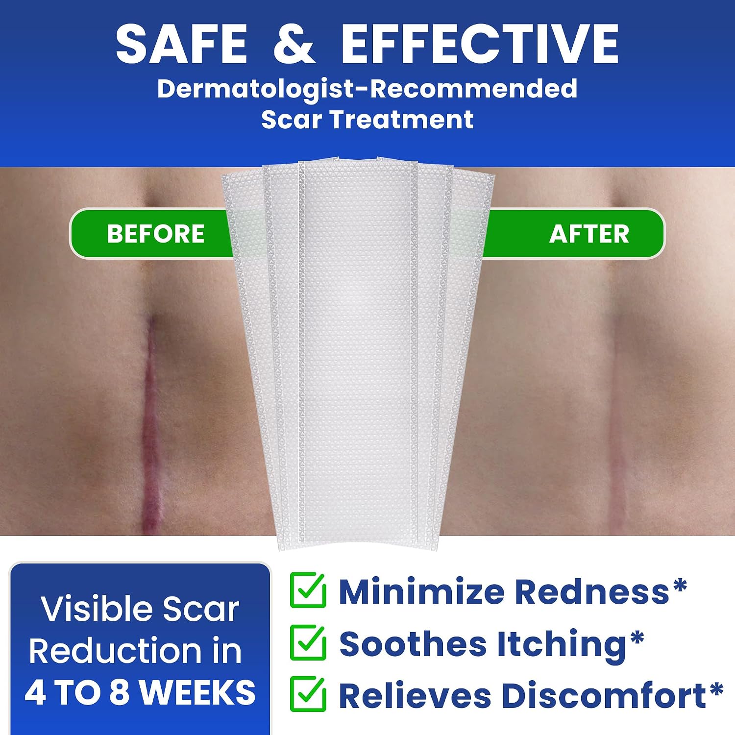 AWD Silicone Scar Sheets for Scar Removal - Extra Thick 0.5mm Silicone Scar Tape for Surgical Scars, C Section, Keloid - Silicone Skin Patches Extra Thick 0.5mm Longer Use (5 Pcs, 1.6” x 6”), Clear