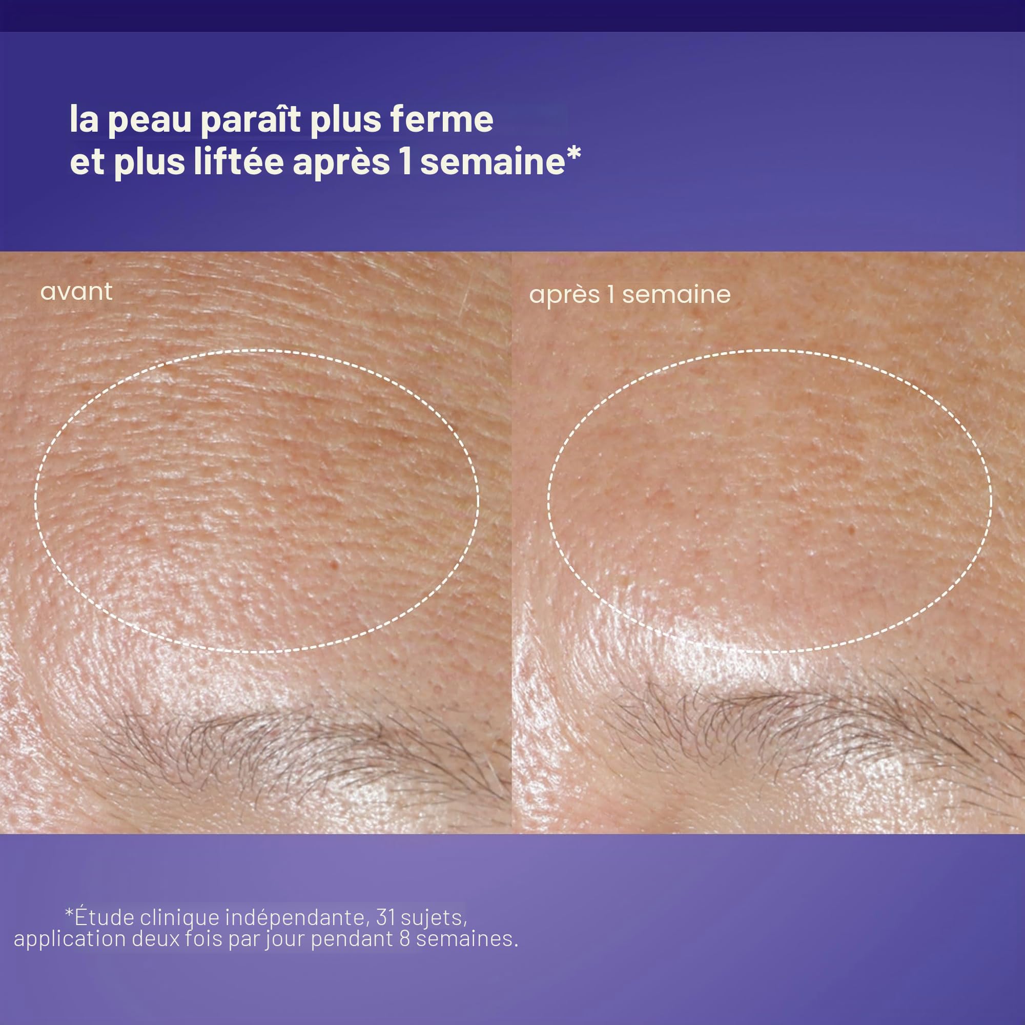 Dermalogica Phyto Nature Oxygen Cream 50ml | Soin hydratant léger qui raffermit, repulpe et redonne de l'énergie aux peaux matures pour un éclat retrouvé.