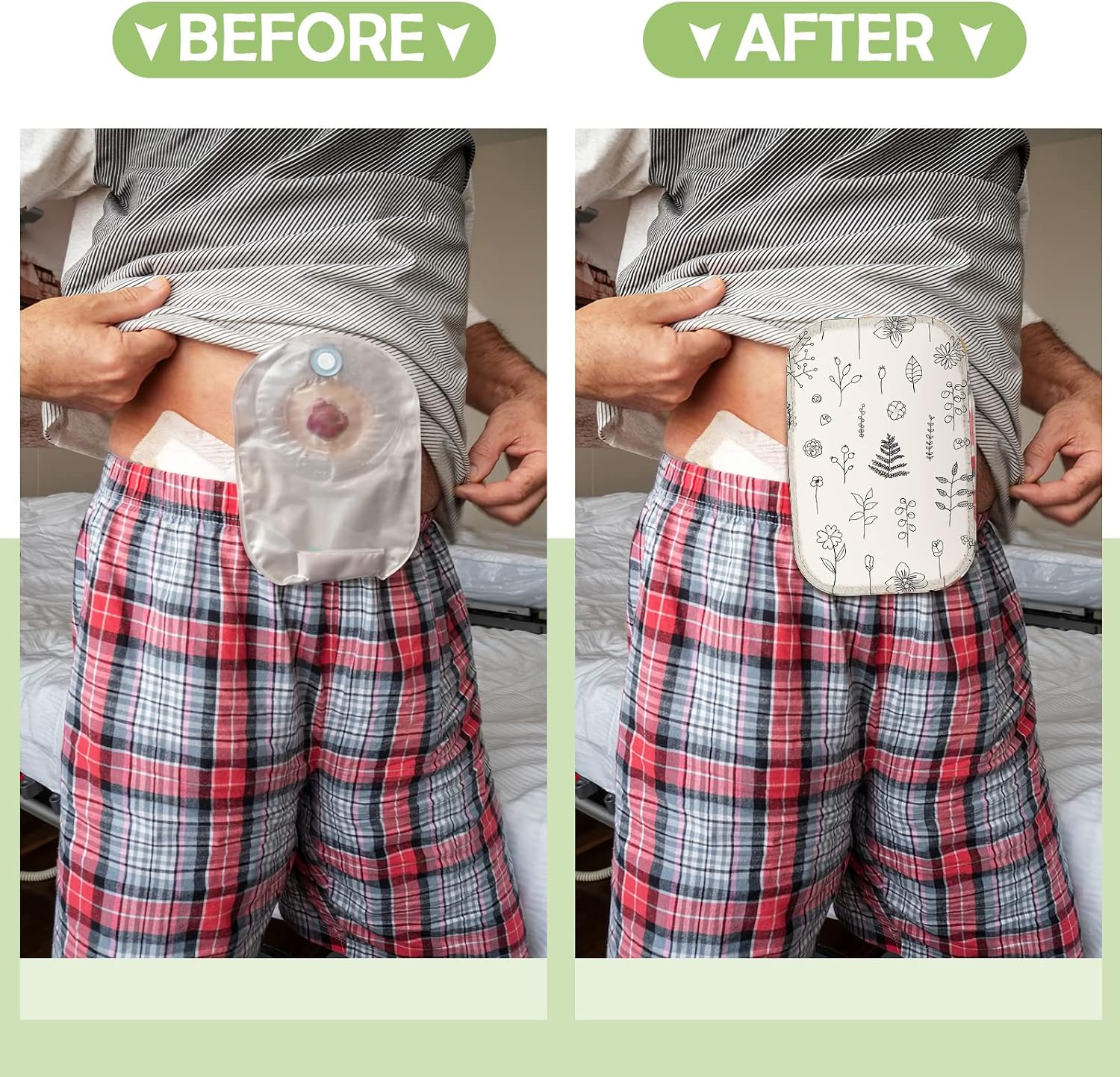Weewooday 9 Pcs Ostomy Bag Covers Waterproof Ostomy Shower Cover Lightweight Colostomy Bags Reusable Washable Wrap with Adjustable Opening Colostomy Supplies for Women Men Care Protector