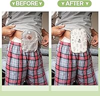 Vista 5 de Weewooday 9 fundas para bolsas de ostomía, impermeables, para ducha, bolsas de colostomía ligeras, reutilizables, lavables, con apertura ajustable
